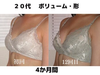 バストサロン メルベイユ(Merveile)/デコルテ～ボリュームUP/形整う