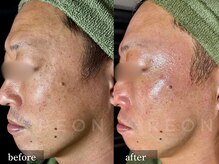 レオンザビューティー(REON the BEAUTY)