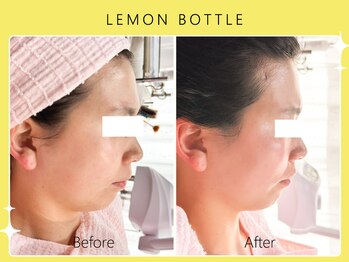 シロカネ イオンタウン西熊本店(SHIROKANE)/レモンボトル☆