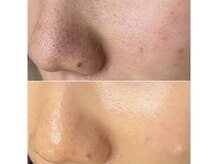 スイ(SUI)の雰囲気（ニキビ肌・毛穴のお悩みの方へ）