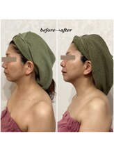 グレイスボディ ヨークタウン坂東店(Grace Body)/小顔ビフォーアフター