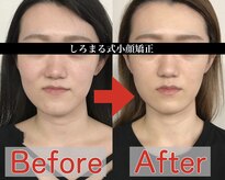 アベックトア(Avectoi)