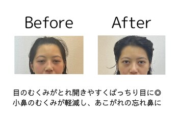 オリナ(olina)/-before & after-