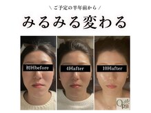キュープ 福岡東店(Qpu)