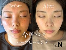 ザ エヌ(The N)の雰囲気（小顔×美肌メニューも大変人気のコースとなります）