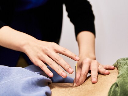 東邦鍼灸院 接骨院 上石神井駅前店の写真