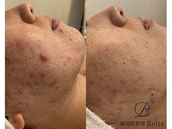 ベル 新宿三丁目(Belle)