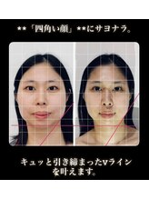 真美(Sinbi)/リターンフェイシャル5回コース