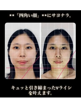 真美(Sinbi)/リターンフェイシャル5回コース