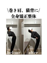 はぴねす鍼灸整骨院 飯田橋サクラテラス院/【飯田橋】施術変化1回