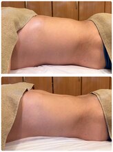 クレアス 勝どき(CREAS)/40代男性腸揉み1回の変化