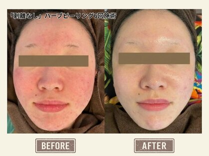 とびきりエステ 沼津店の写真