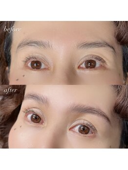 ニム(nim)/Hollywood brow lift