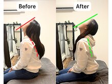 整体院 爽良/【札幌/大通り】首肩こり改善