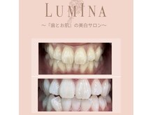 ルミナ(LUMINA)