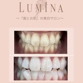 ルミナ(LUMINA)
