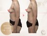 【ママのお悩み★】垂れ乳・離れ乳改善バストケア♪ ￥6,980◎