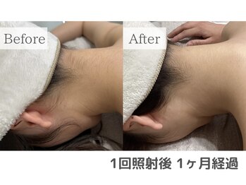 セオリー(Theory)/Before After