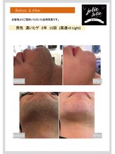 ジョリージョリー(jolie jolie)/参考資料６