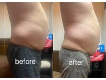 ヤン リン 整体(Yang Ling 整体)/ぼっこりお腹もくびれボディ