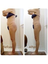 ピーエフ トウキョウ(PF TOKYO)/ハイパーナイフEX/　全身痩せ