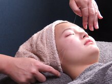 トータルビューティケア アヤ(Aya)/絹糸脱毛