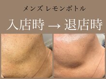 ビーエルティー(blt)/メンズ &nbsp;レモンボトル