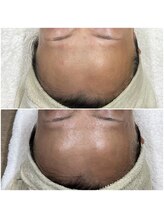 メイス 福井店(MEIS)/お客様before、after