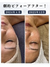 シーフェイス 横浜店(SEE FACE)/定期的な肌ケアでココまで変化！