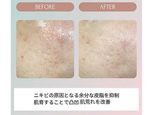 ノーブル(NOBLE)/ムートンホイップスパ大阪/野田