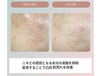 ノーブル(NOBLE)/ムートンホイップスパ大阪/野田