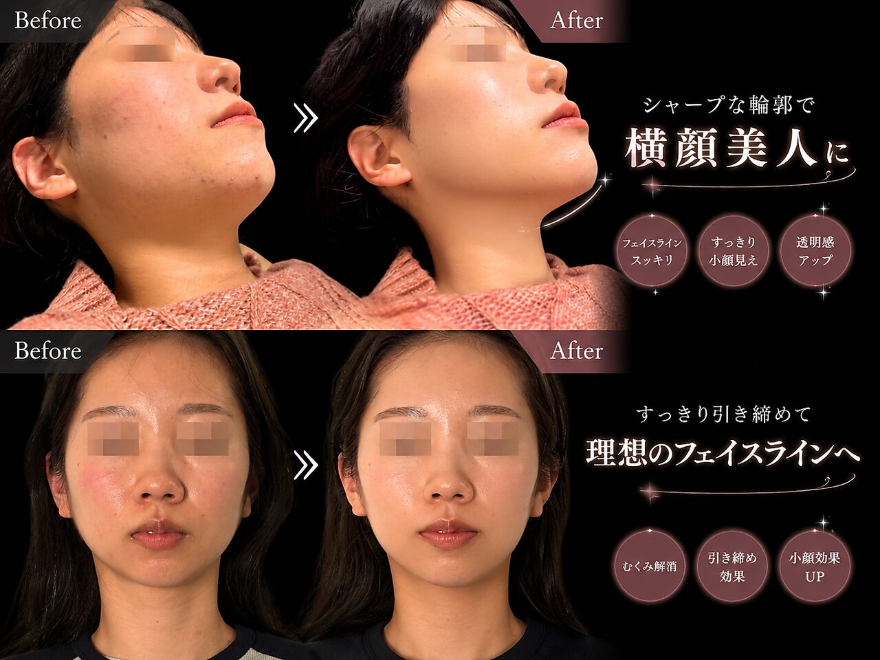 クアダ 天神(QUADA)｜ホットペッパービューティー