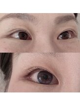 リボーテ(Reboaute)/アップフォースリフト