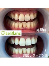 ルブラン 奈良店(Le Blanc)/【2回でトーンup!!】