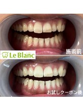 ルブラン 奈良店(Le Blanc)/お試しだけでも