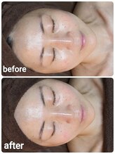 ウララ(ulala)/セラピール1回目