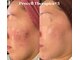 イーフェイス(e face)の写真