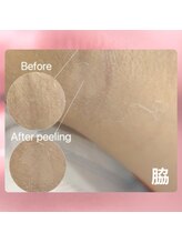 フィル 名駅店(fil)/ローマピンク【脇】