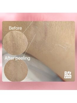 フィル 名駅店(fil)/ローマピンク【脇】