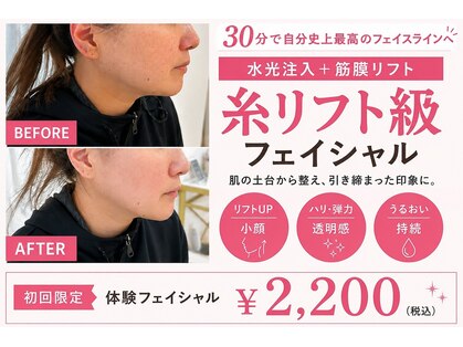 【肌管理×小顔・毛穴改善フェイシャルサロン】MavY.井尻店(ハーブピーリング/毛穴)の写真