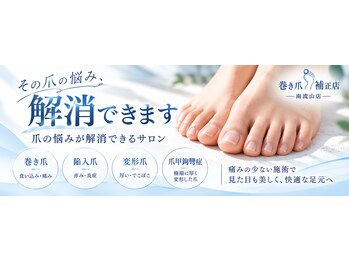 巻き爪補正店　南流山店【11月5日OPEN（予定）】の写真/巻き爪のスペシャリストによる施術で長年の爪の悩みを解消！【カウンセリング込☆巻き爪補正１ヵ所￥5500】