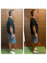プレシャスサロン(precious salon)/◆姿勢矯正1回での変化◆