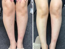 ゆうだい整骨院/むくみが取れて脚スッキリ美脚に
