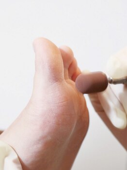 ヴィーナネイル ゆめタウン広島店(VinaNail)の写真/ガサガサ足裏しっとり柔らか♪【フット角質ケア(保湿クリーム仕上げ)】固くなった"かかと"もつるつる◎