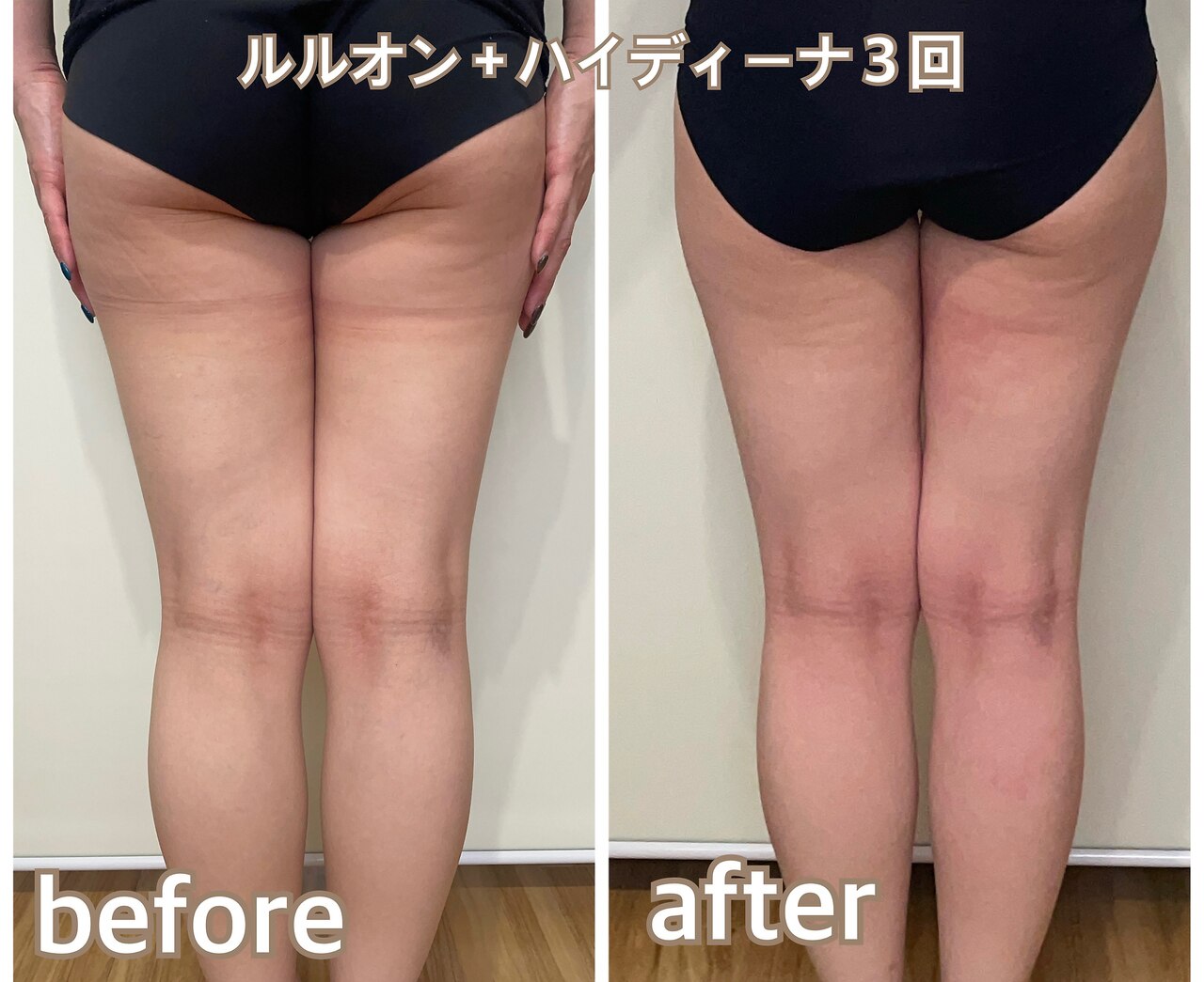 ヨサパーク シピ(YOSAOARK Chipie)｜ホットペッパービューティー