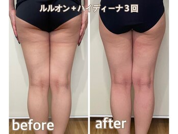 ヨサパーク シピ(YOSAOARK Chipie)