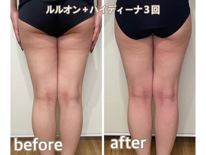 ヨサパーク シピ(YOSAOARK Chipie)の写真