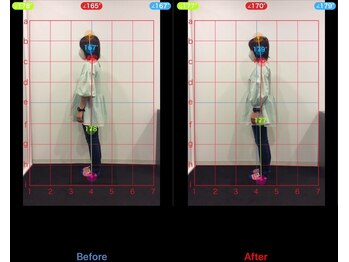 ケアハウス 藤沢(CARE HOUSE)/施術効果写真☆(before after)