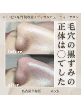 ストック(stock)/