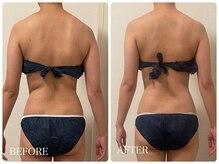 イリゼ(IRISER)/【20代ブライダル】上半身集中！